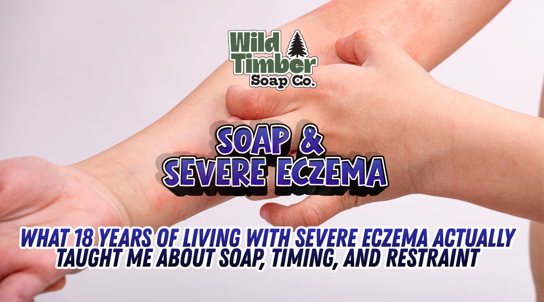 What 18 Years of Living With Severe Eczema Actually Taught Me About Soap, Timing, and Restraint