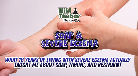 What 18 Years of Living With Severe Eczema Actually Taught Me About Soap, Timing, and Restraint